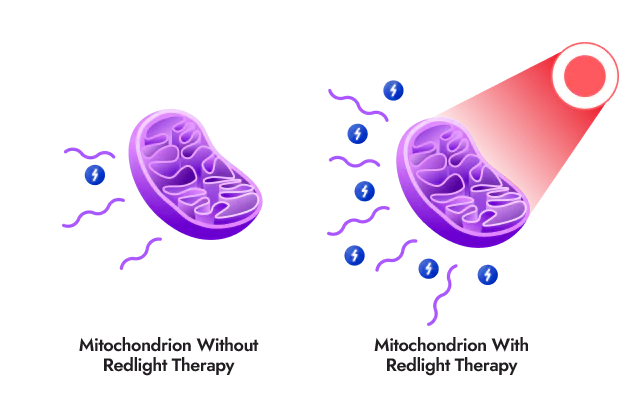 Red Light Mitochondrion